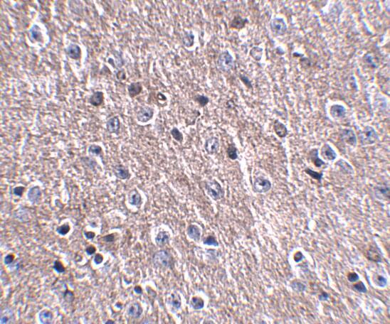 CDIP Antibody - BSA Free