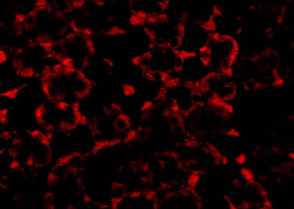 MTCH2 Antibody - BSA Free
