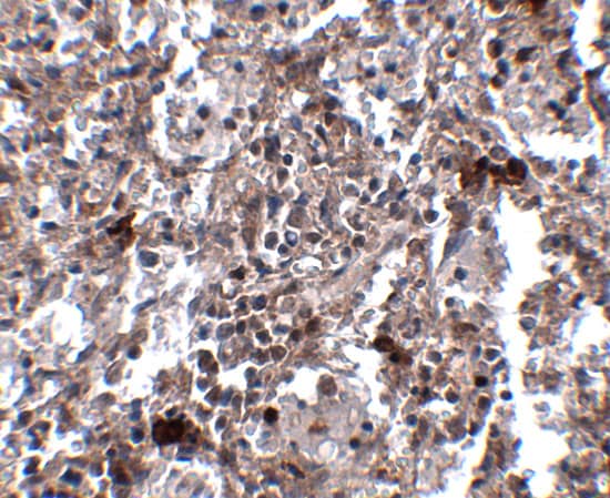KCTD15 Antibody - BSA Free
