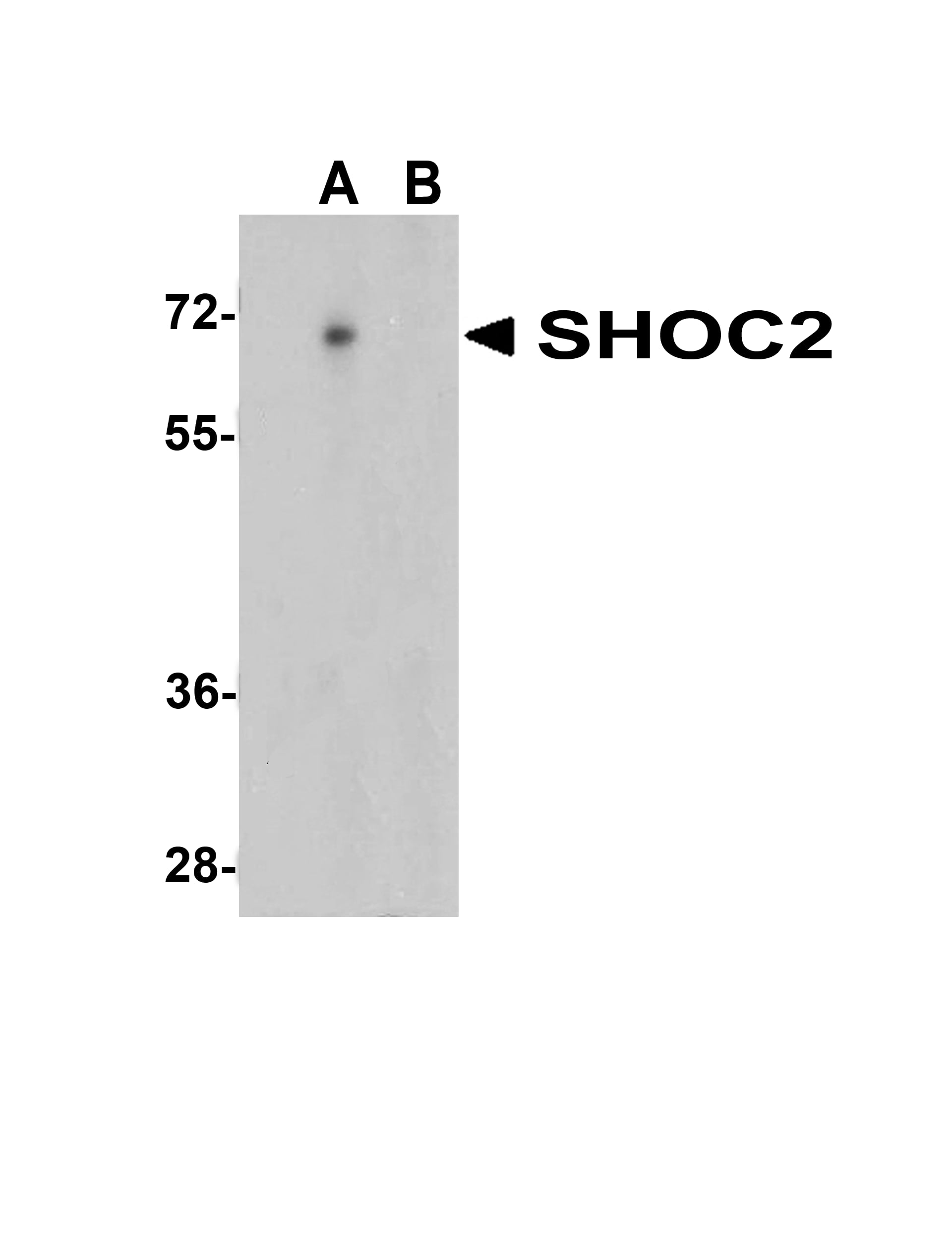 SUR-8 Antibody - BSA Free