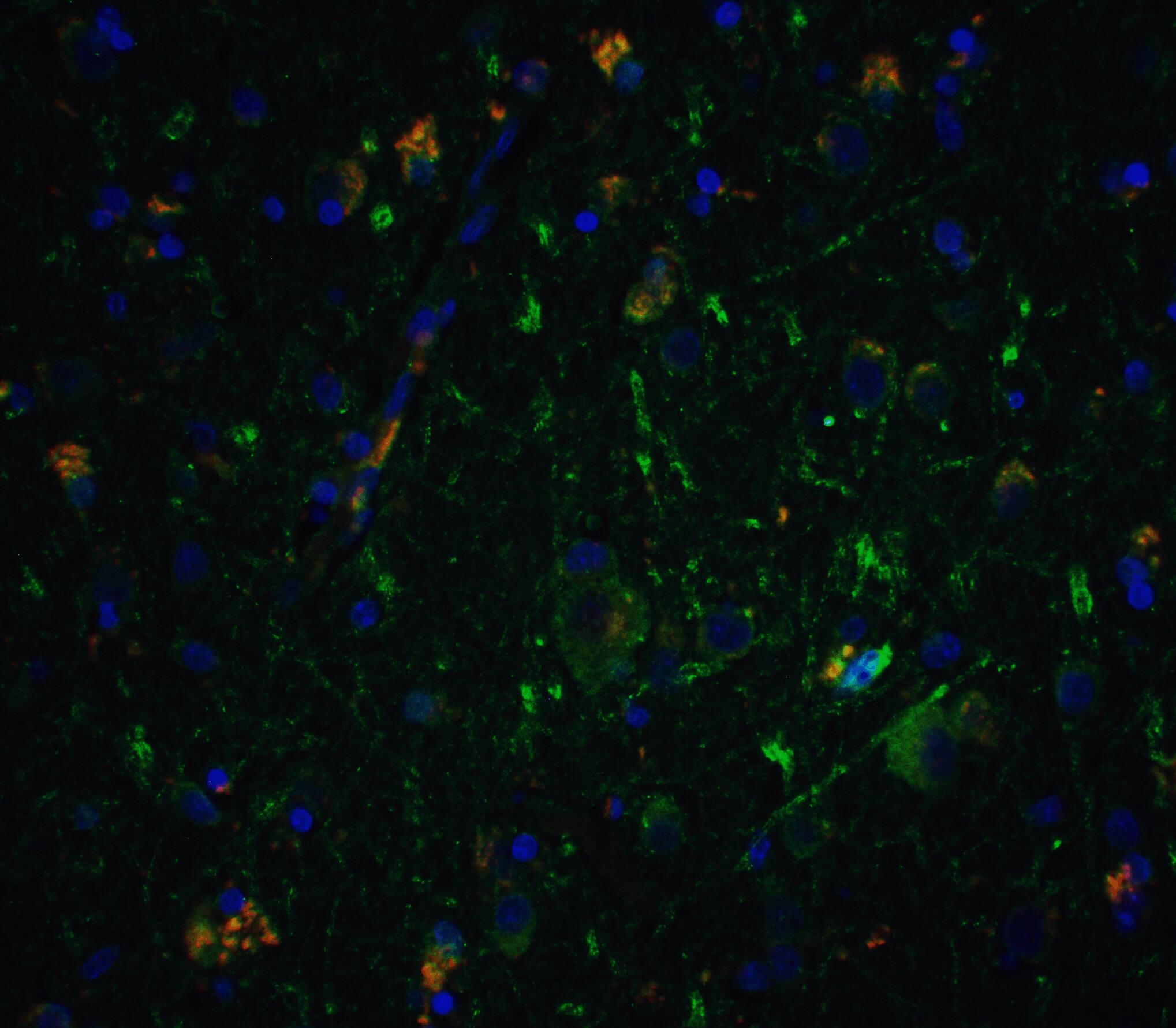 Neurturin Antibody - BSA Free