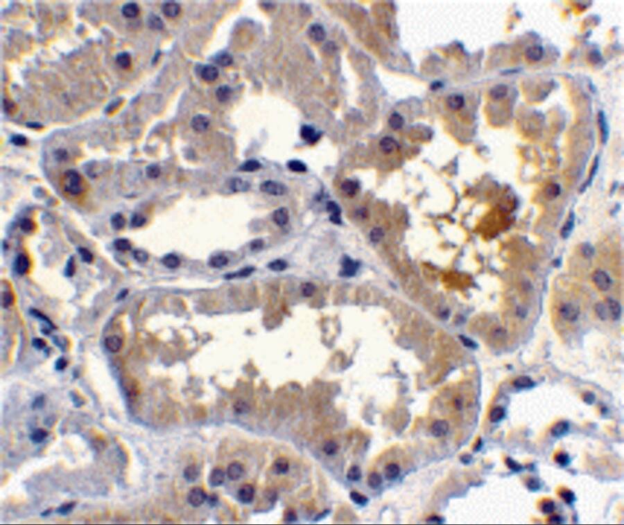 RAIDD/CRADD Antibody - BSA Free