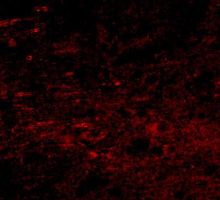 Polypeptide GalNac Transferase 10/GALNT10 Antibody - BSA Free