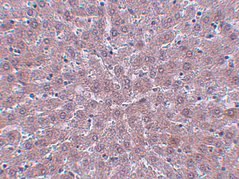JMJD1B Antibody - BSA Free