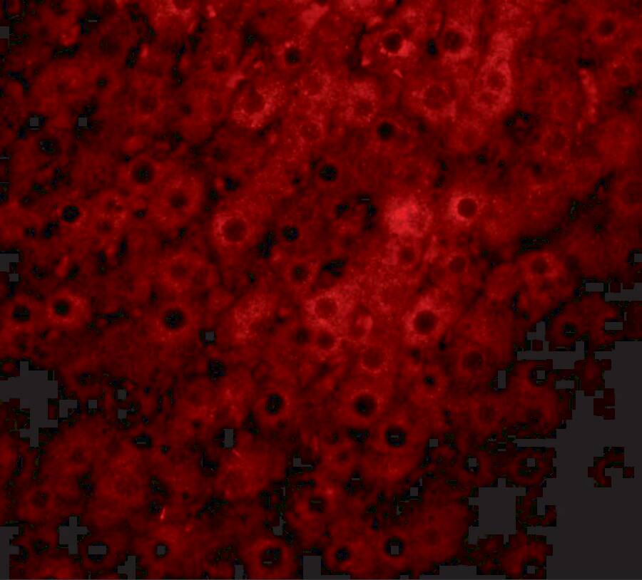 JMJD1C Antibody - BSA Free