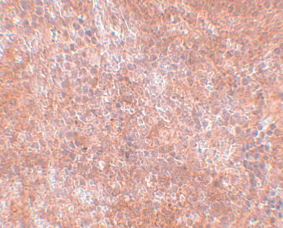 JMJD8 Antibody - BSA Free