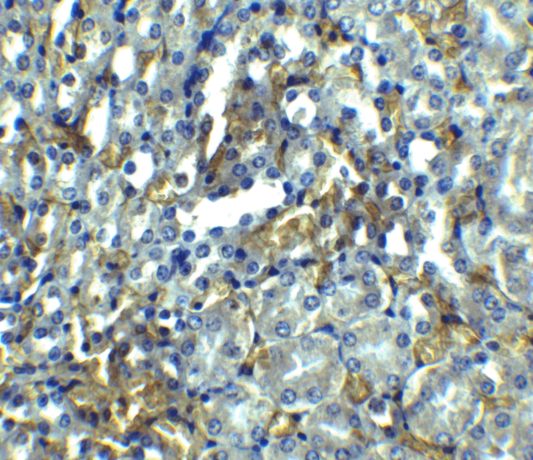 RIPK1/RIP1 Antibody - BSA Free