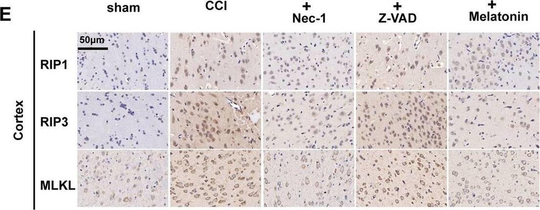 RIPK1/RIP1 Antibody - BSA Free