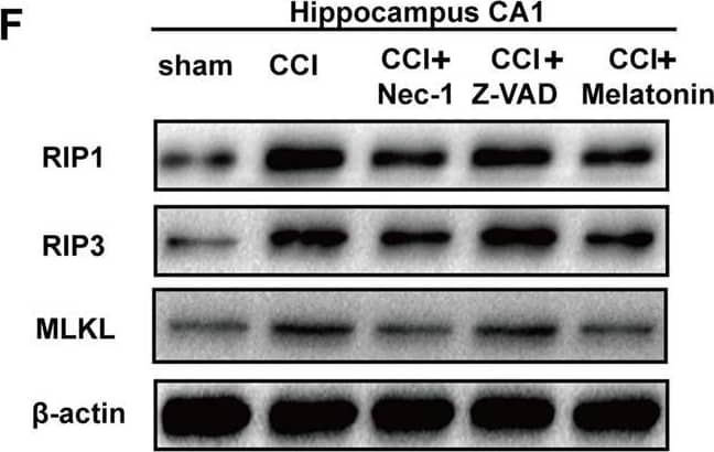 RIPK1/RIP1 Antibody - BSA Free