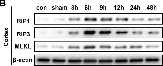 RIPK1/RIP1 Antibody - BSA Free