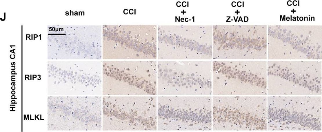 RIPK1/RIP1 Antibody - BSA Free