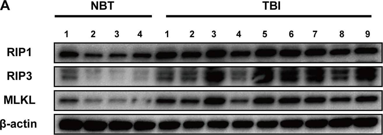 RIPK1/RIP1 Antibody - BSA Free