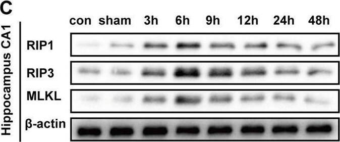RIPK1/RIP1 Antibody - BSA Free