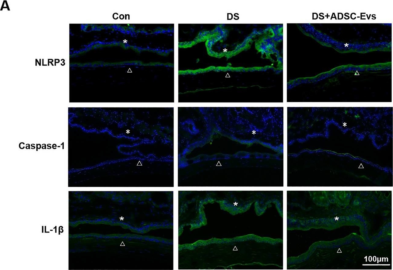 NLRP3/NALP3 Antibody - BSA Free