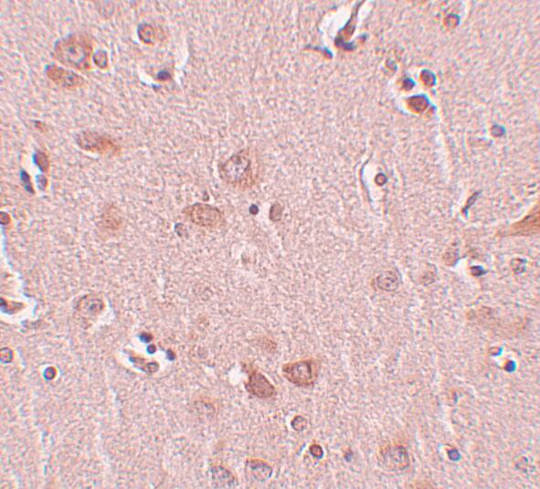 PLEKHM2 Antibody - BSA Free