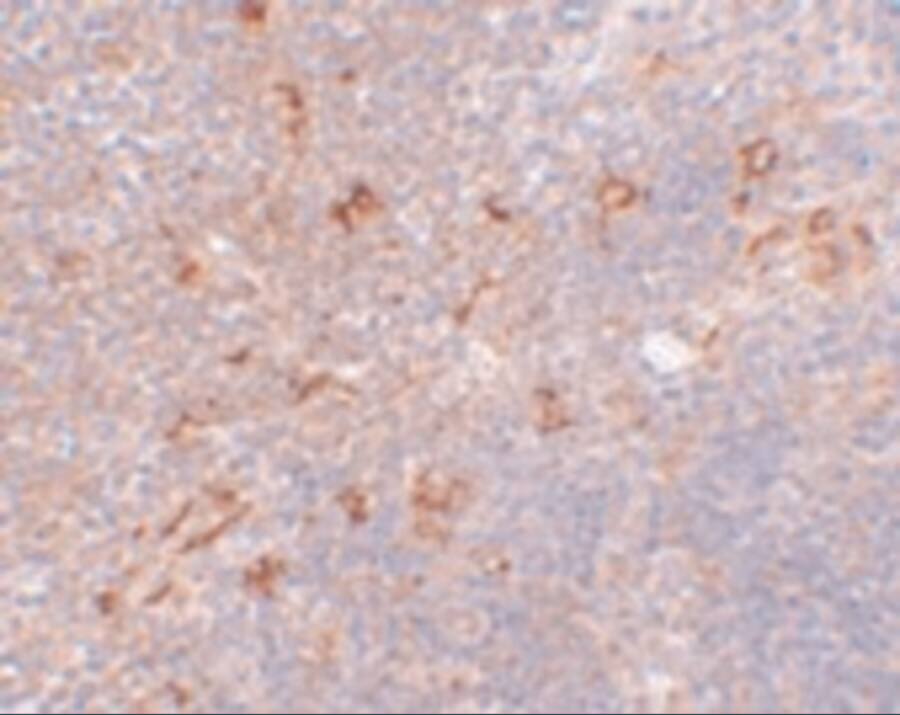 NAT11 Antibody - BSA Free