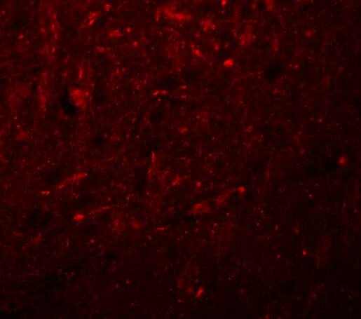 KCNK18 Antibody - BSA Free