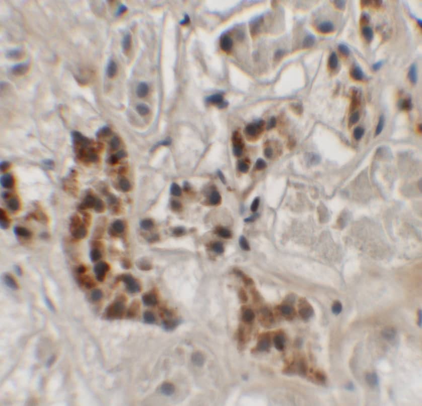 SPRYD4 Antibody - BSA Free