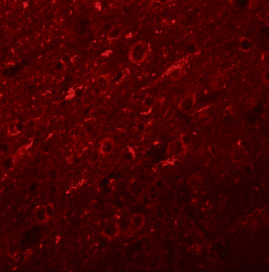 Synaptogyrin 2 Antibody - BSA Free