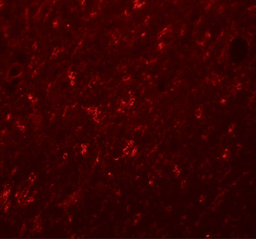 Synaptogyrin 4 Antibody - BSA Free