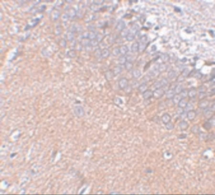 Synaptogyrin 4 Antibody - BSA Free