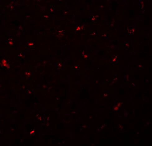 CALHM1 Antibody - BSA Free