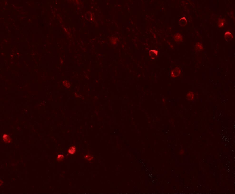 SPRYD3 Antibody - BSA Free