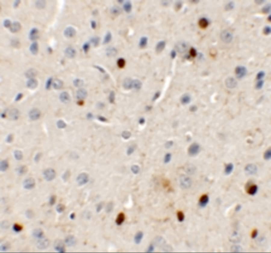 SPRYD3 Antibody - BSA Free