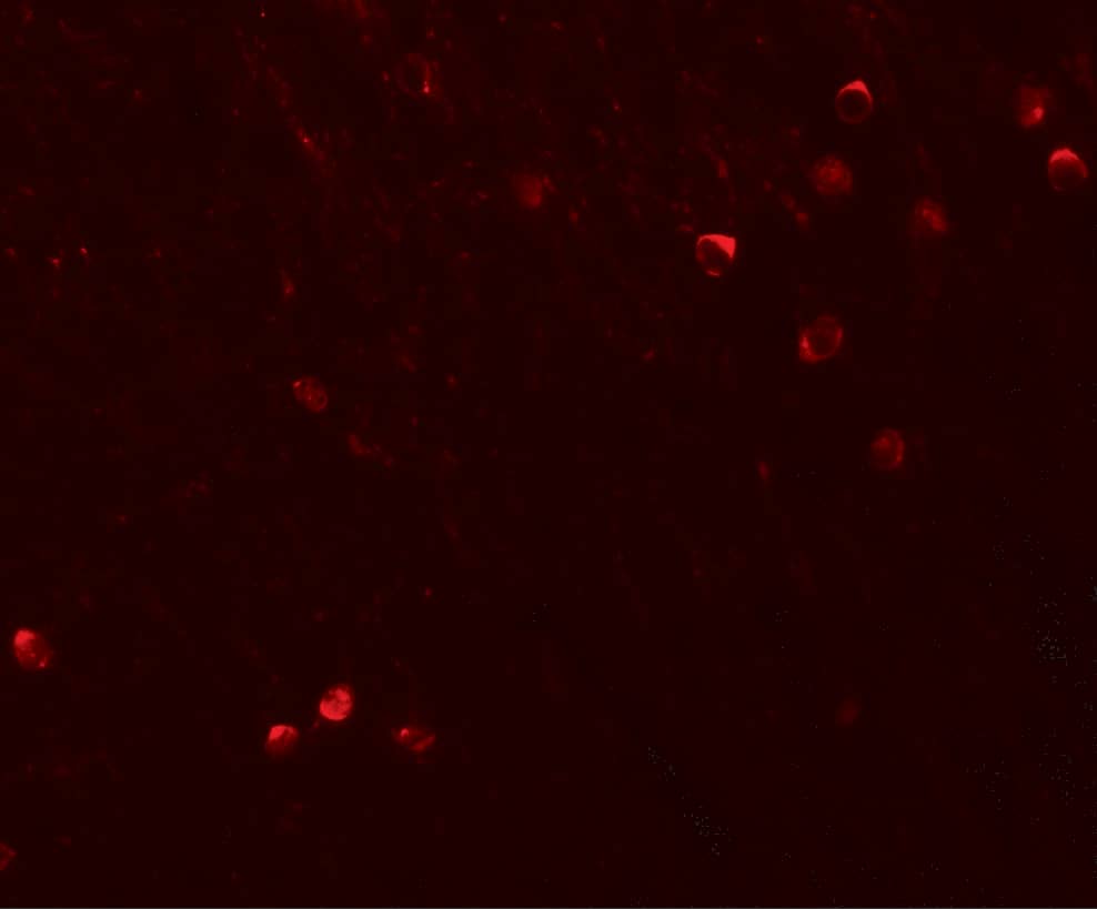 SPRYD3 Antibody - BSA Free