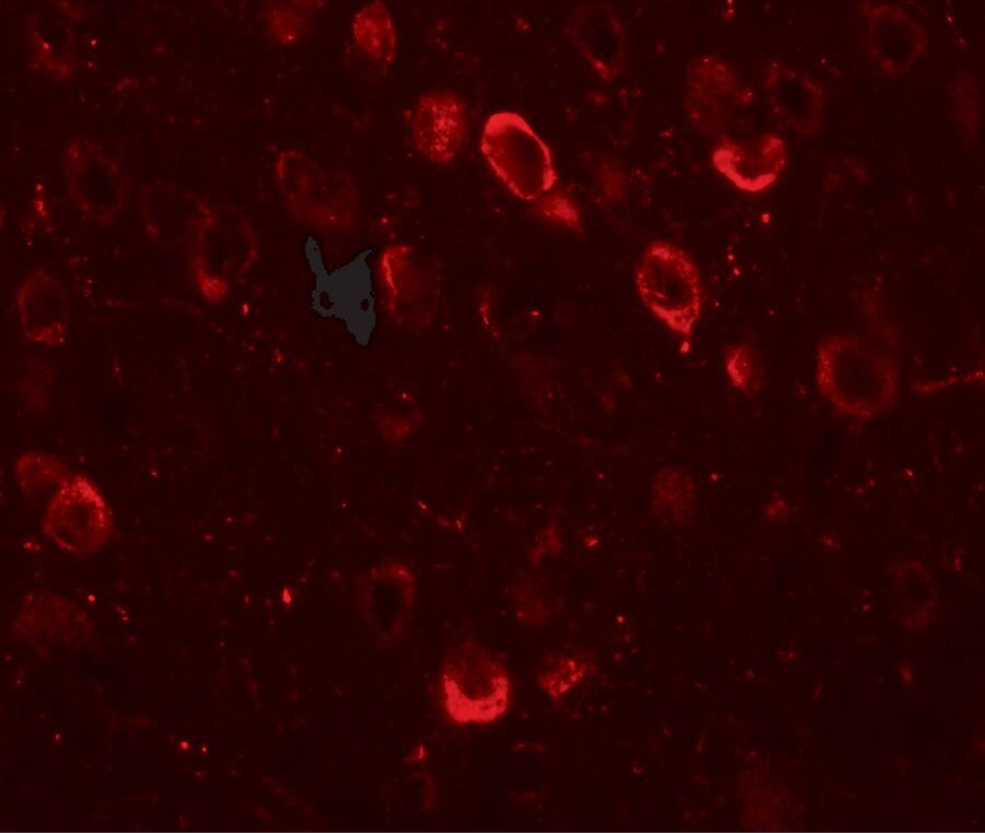 CMYA5 Antibody - BSA Free