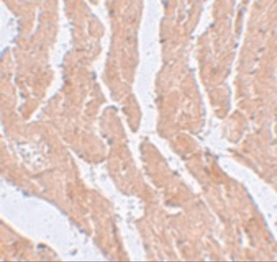 LZTR1 Antibody - BSA Free