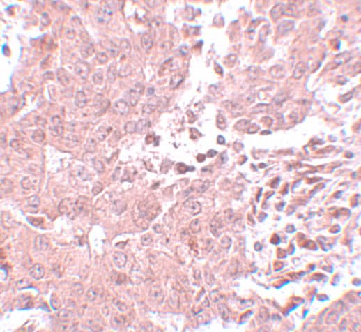 Breast carcinoma amplified sequence 3 Antibody - BSA Free