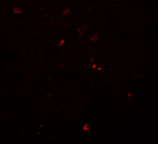 Breast carcinoma amplified sequence 3 Antibody - BSA Free