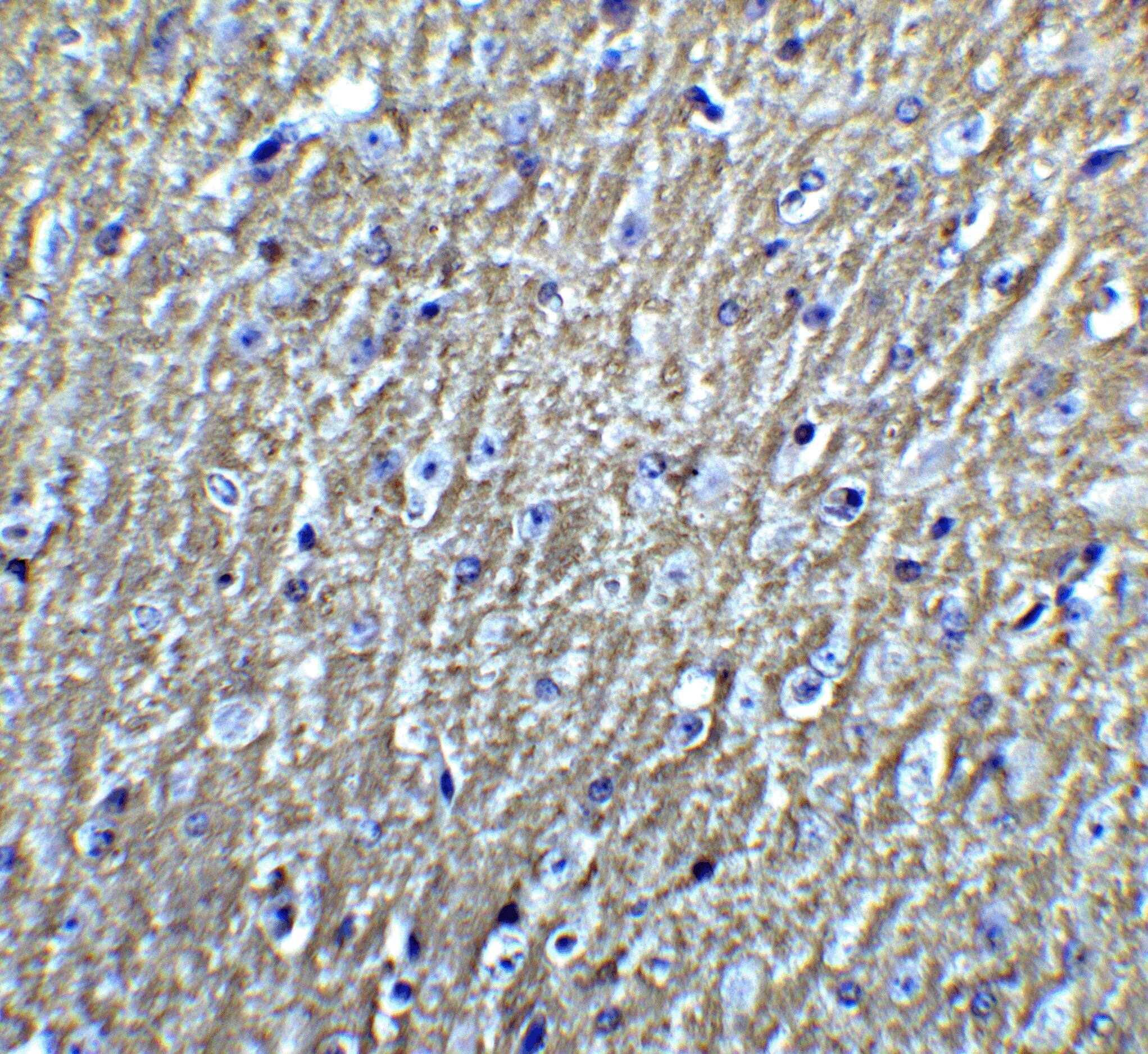 DCLK3 Antibody - BSA Free