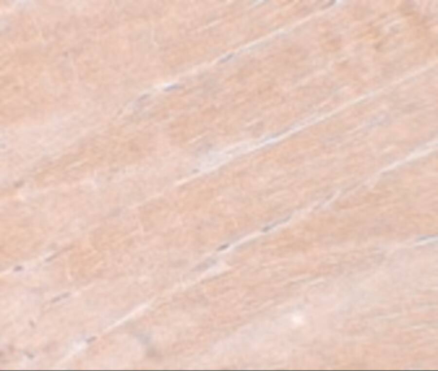 MYBPC2 Antibody - BSA Free