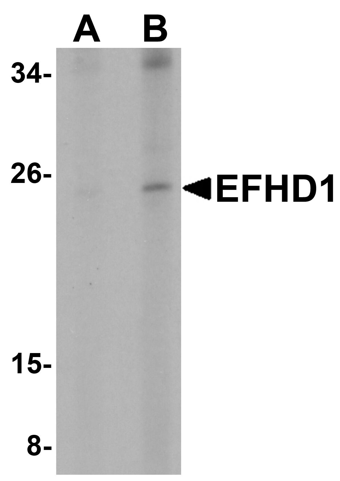 EFHD1 Antibody - BSA Free