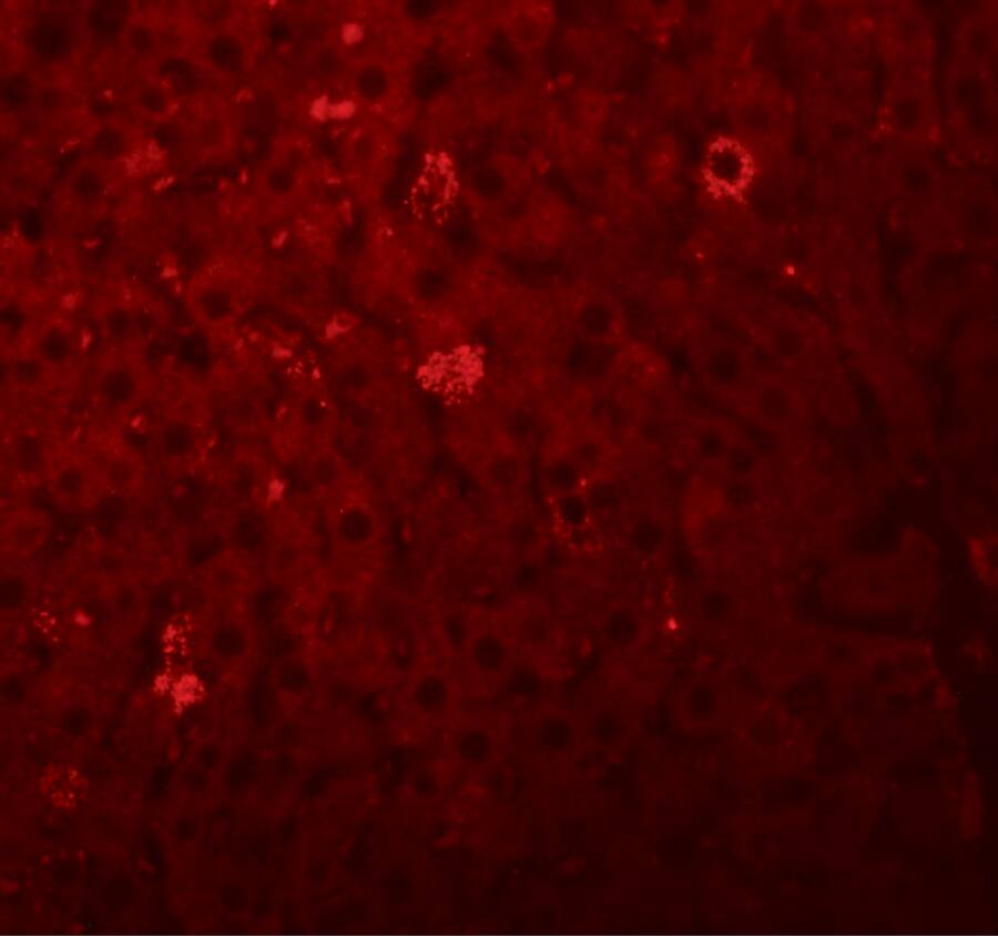 LYRM1 Antibody - BSA Free