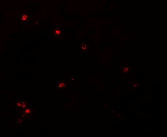 NDUFB9 Antibody - BSA Free