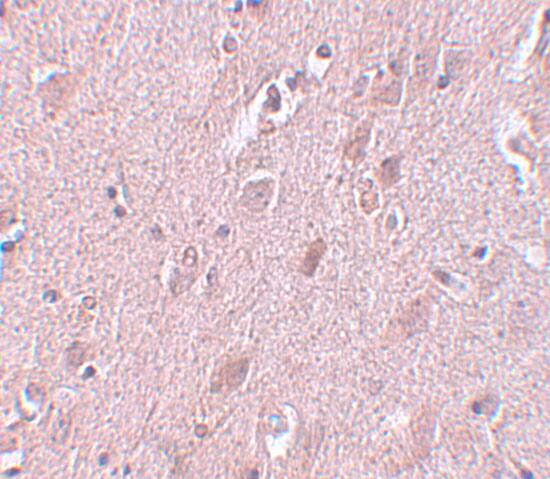 ZC3H12B Antibody - BSA Free