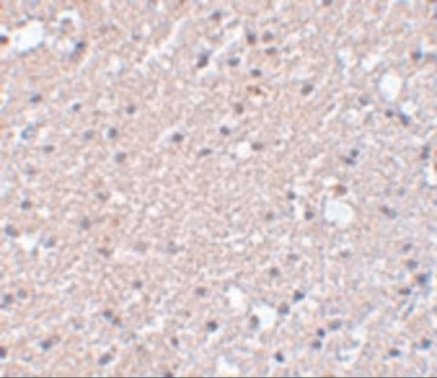 TMEM184A Antibody - BSA Free