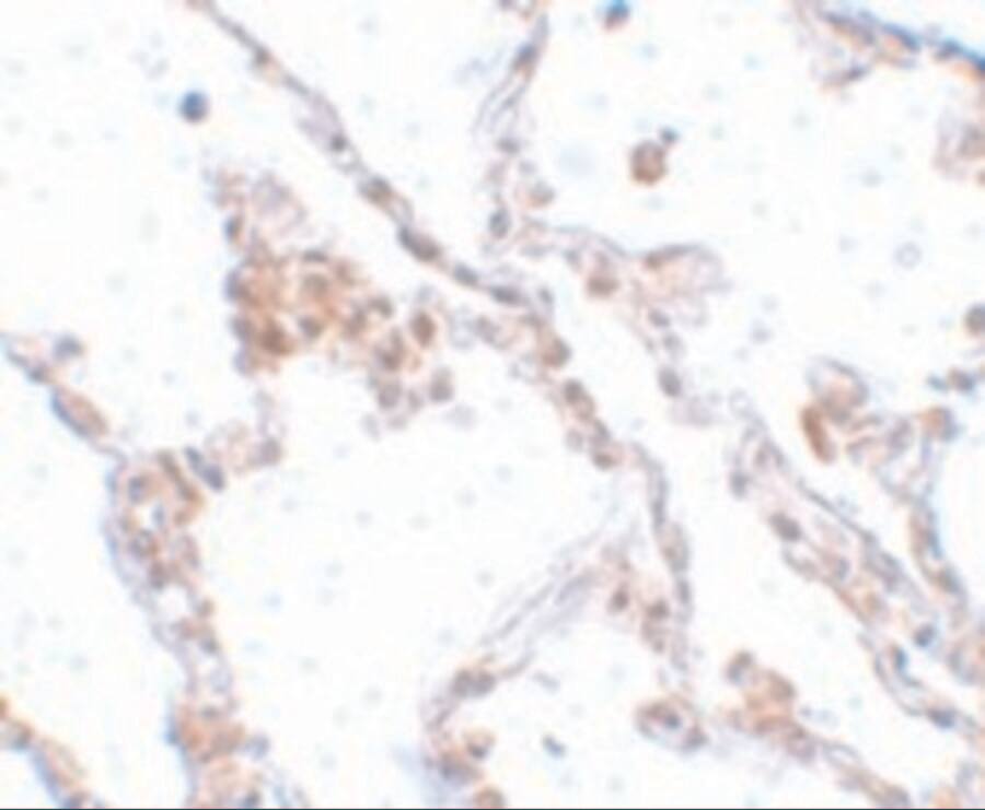 TMEM184B Antibody - BSA Free