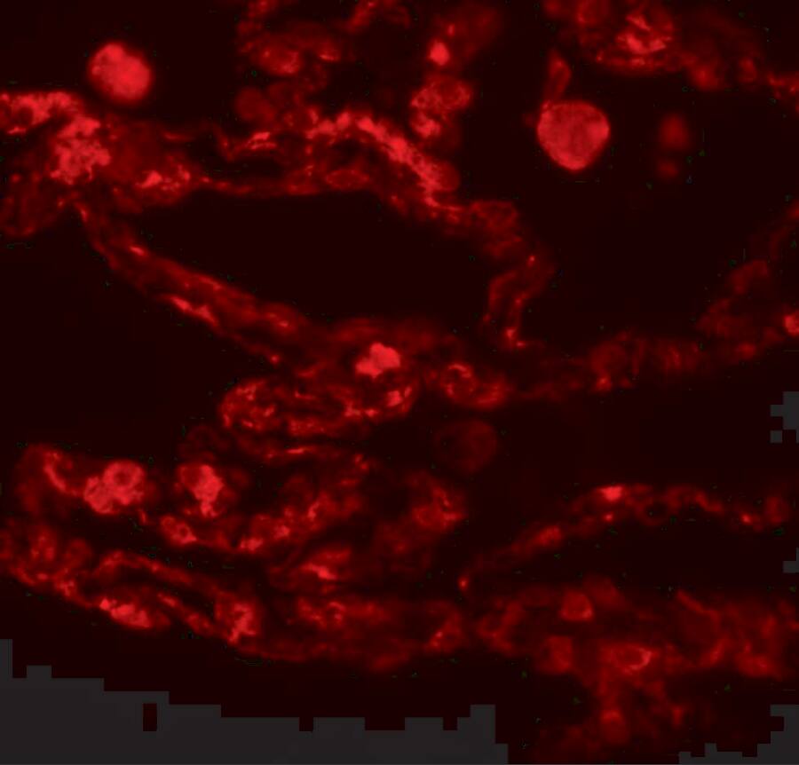 CCDC69 Antibody - BSA Free