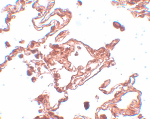CCDC69 Antibody - BSA Free
