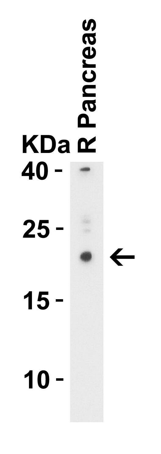 CCDC69 Antibody - BSA Free