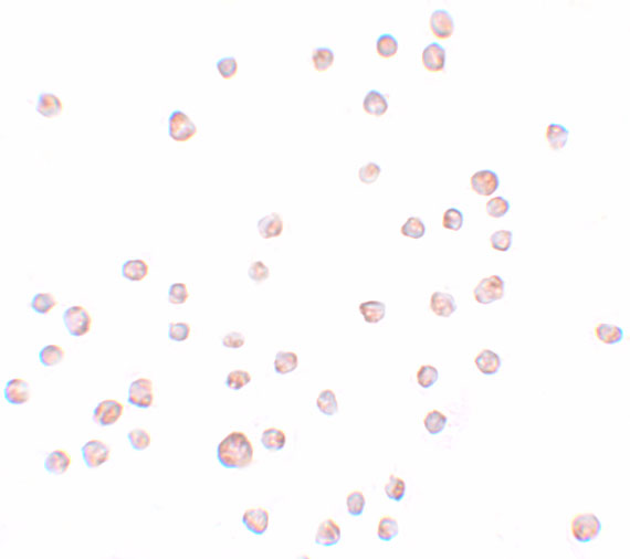 KLHL25 Antibody - BSA Free