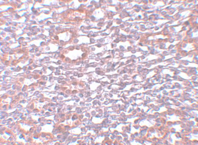 PIAS1 Antibody - BSA Free