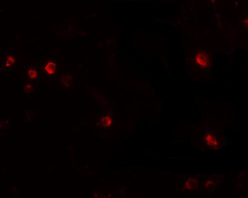USP10 Antibody - BSA Free