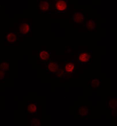 GEMIN2 Antibody - BSA Free