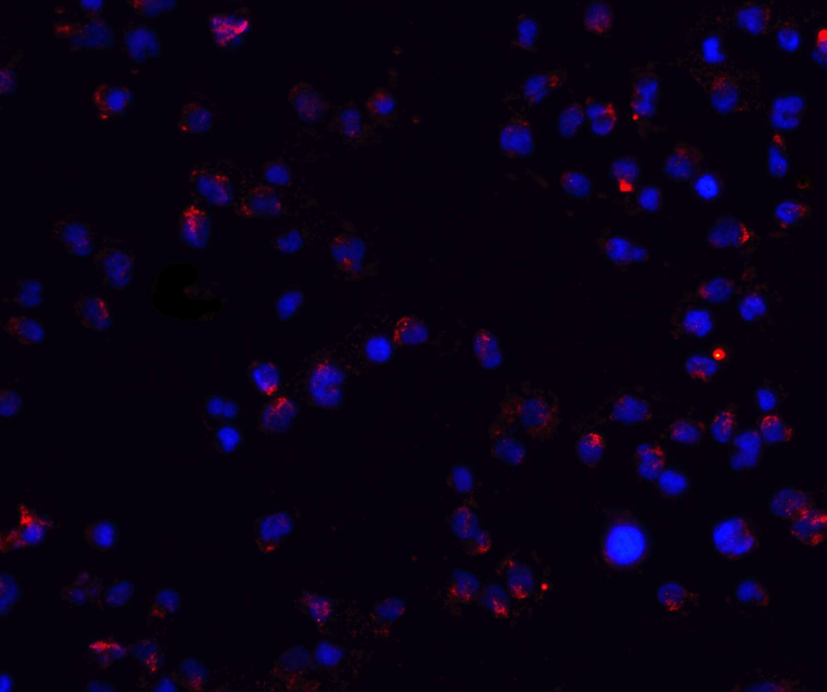 ZEB2 Antibody - BSA Free
