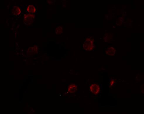 QBRICK/FREM1 Antibody - BSA Free